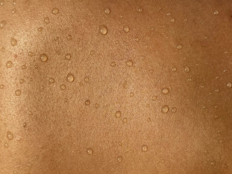 Photo Skin cancer prevention